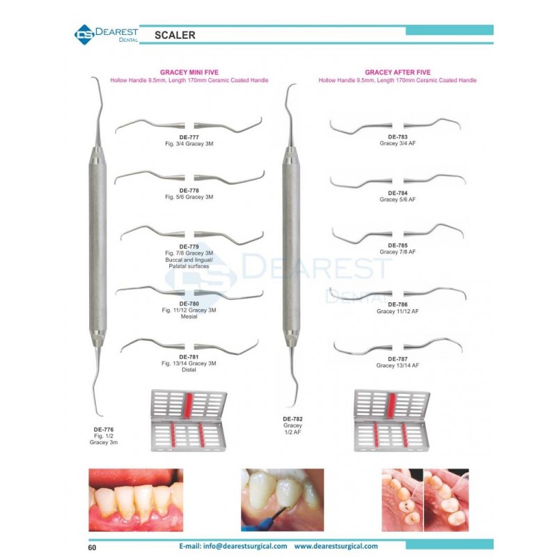 Scaler